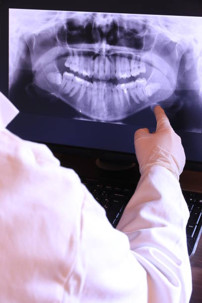 Best Dental Abscess Treatment in Rochelle, IL